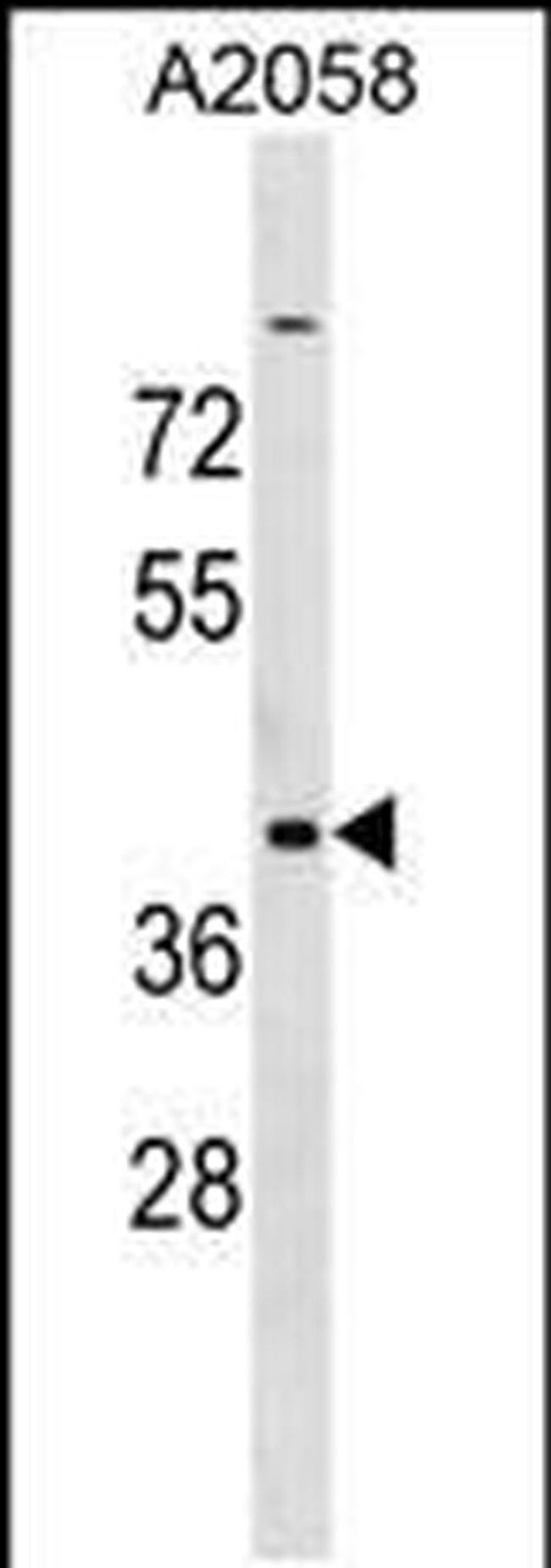 ADAT3 Antibody in Western Blot (WB)