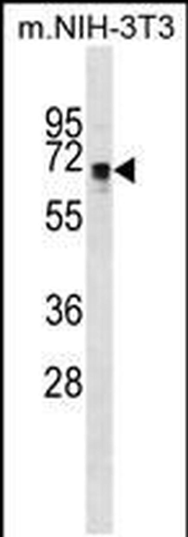 NR1 Antibody in Western Blot (WB)