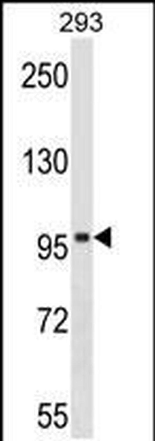 SPIRE1 Antibody in Western Blot (WB)