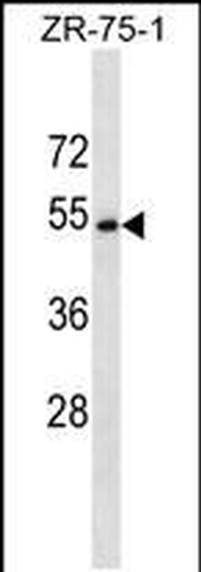 CCDC112 Antibody in Western Blot (WB)