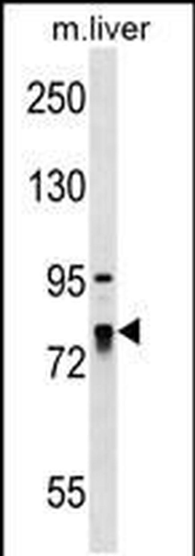 LARP4 Antibody in Western Blot (WB)