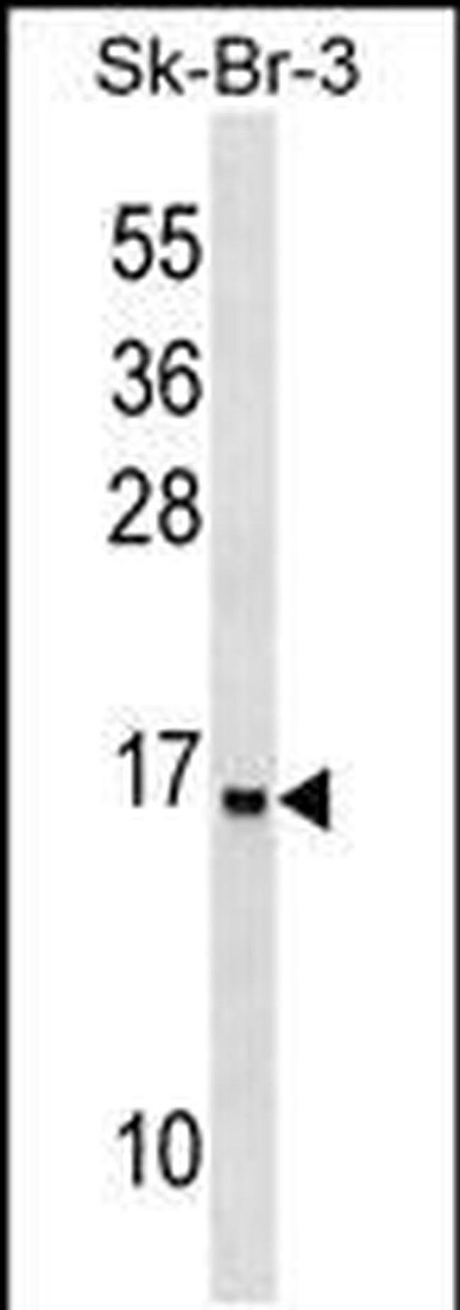 UTS2B Antibody in Western Blot (WB)