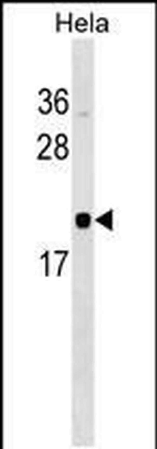 Rwdd1 Antibody in Western Blot (WB)