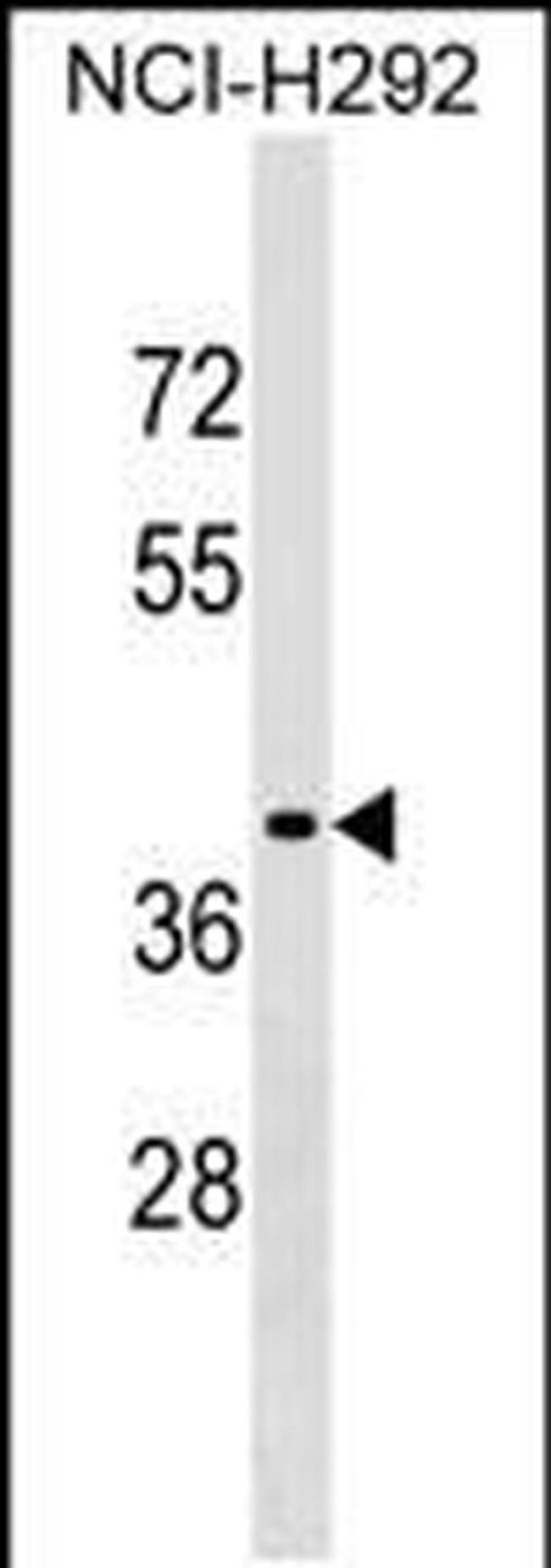 SNX21 Antibody in Western Blot (WB)
