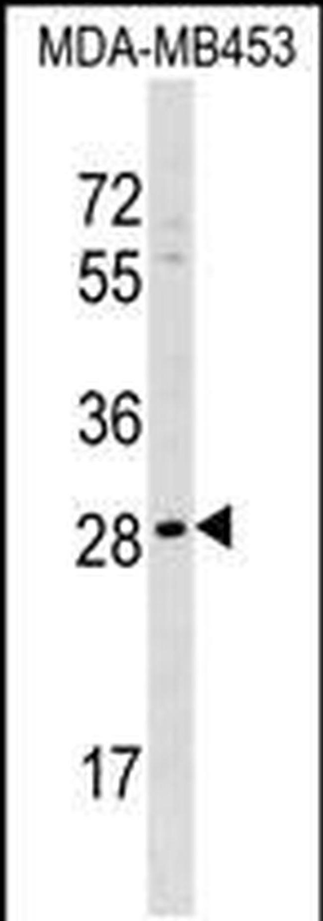 AIDA Antibody in Western Blot (WB)