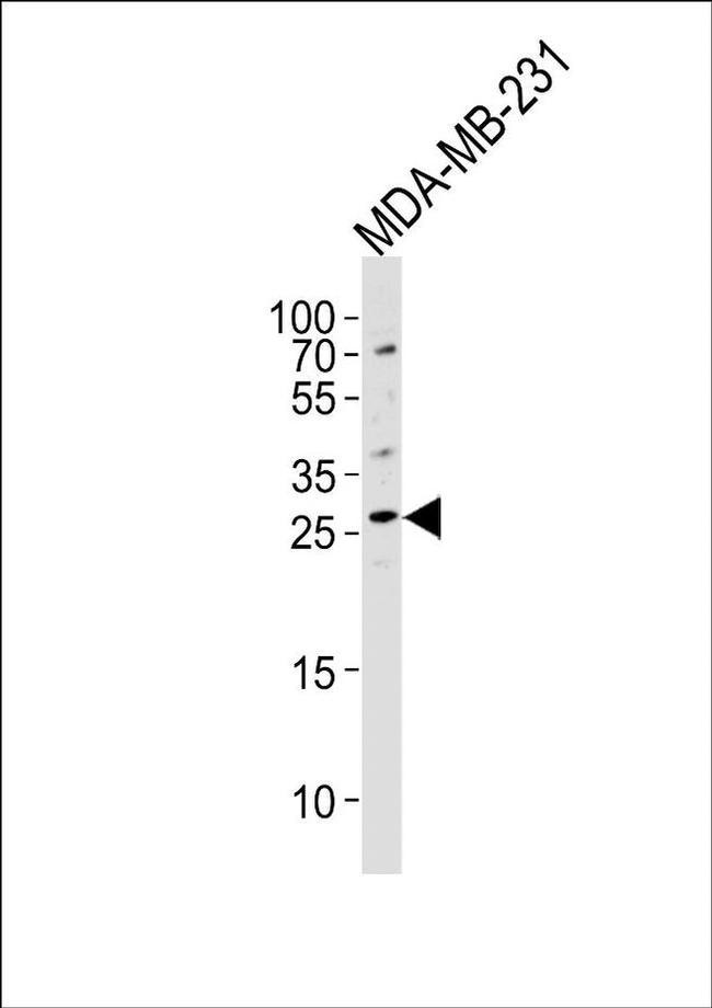 CRISP1 Antibody in Western Blot (WB)