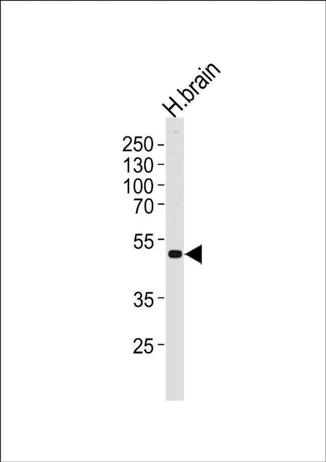 Kir2.2 (KCNJ12) Antibody in Western Blot (WB)