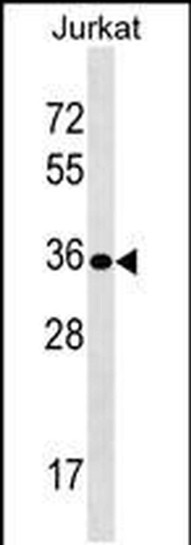 UPK3B Antibody in Western Blot (WB)