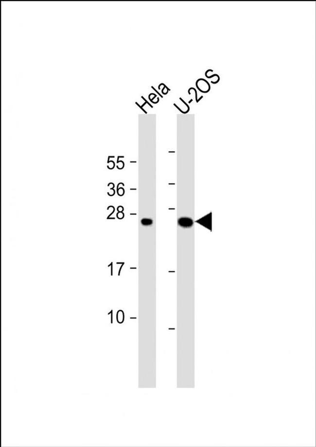 DCTN6 Antibody in Western Blot (WB)