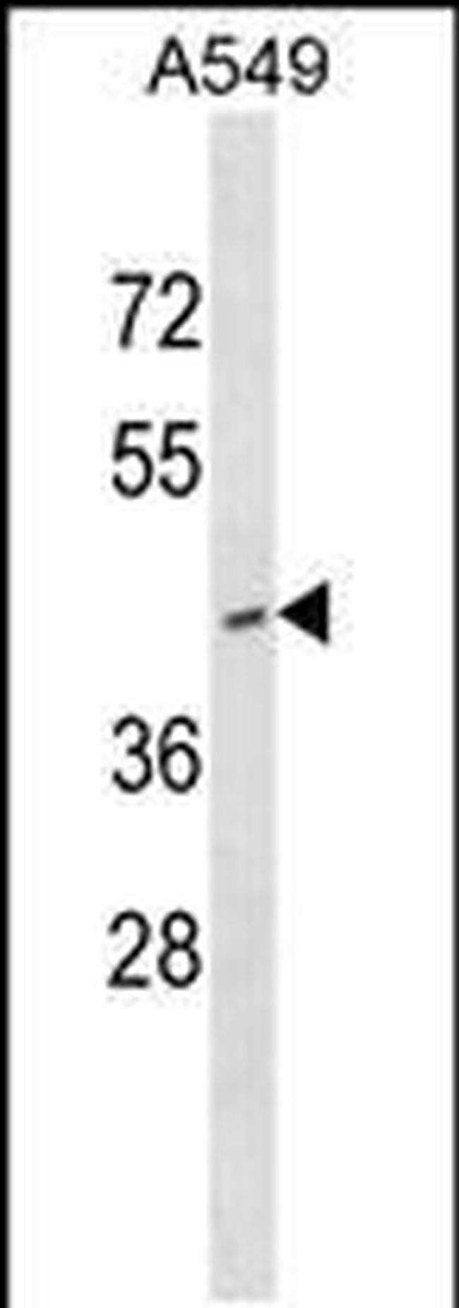 RNF165 Antibody in Western Blot (WB)