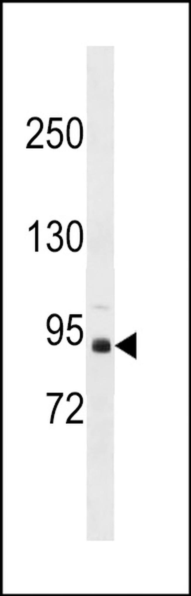 ZBTB49 Antibody in Western Blot (WB)