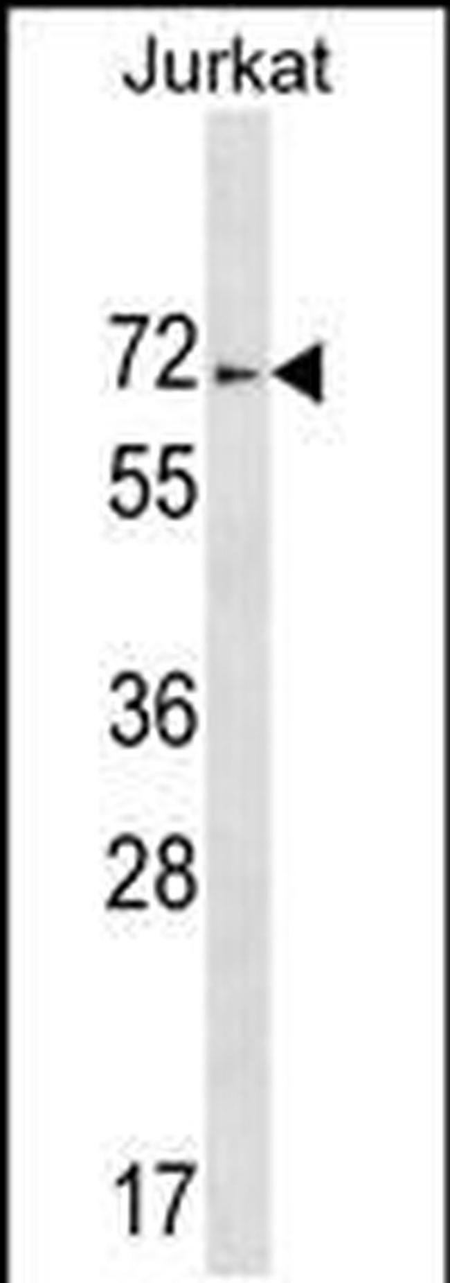 ZNF613 Antibody in Western Blot (WB)
