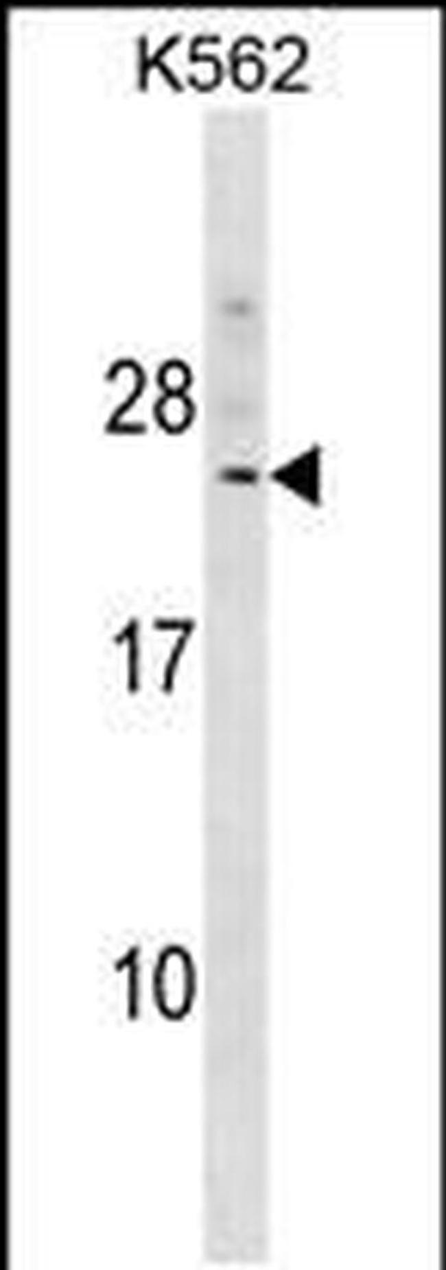 DCAKD Antibody in Western Blot (WB)