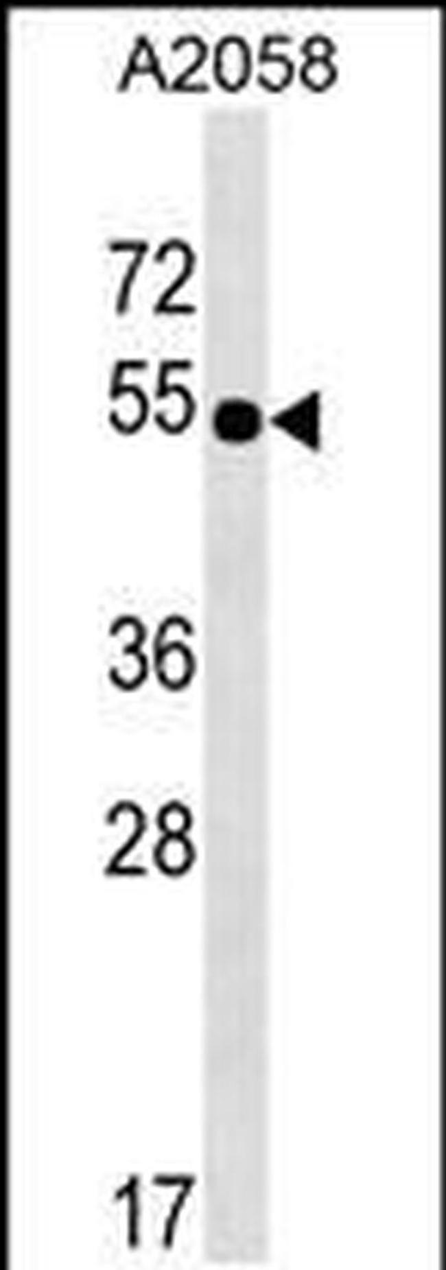 NHEDC2 Antibody in Western Blot (WB)