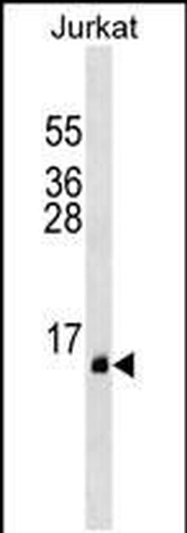 PATE1 Antibody in Western Blot (WB)