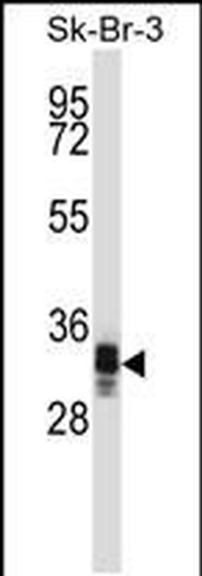 UBXN10 Antibody in Western Blot (WB)