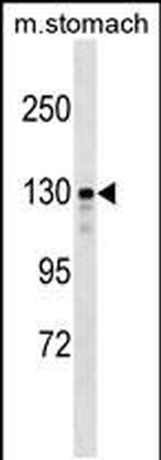 SRGAP1 Antibody in Western Blot (WB)