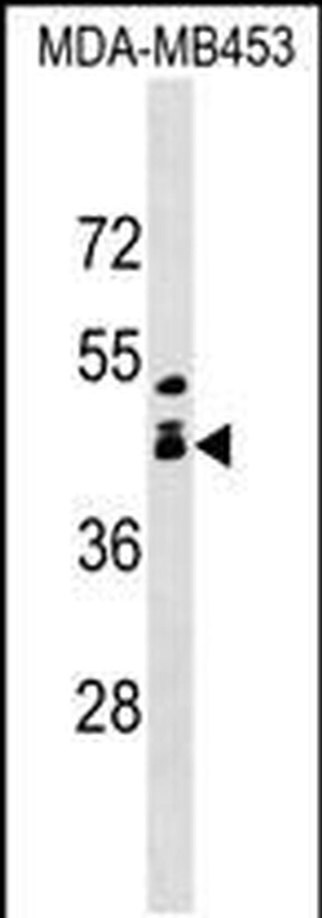 ALX1 Antibody in Western Blot (WB)