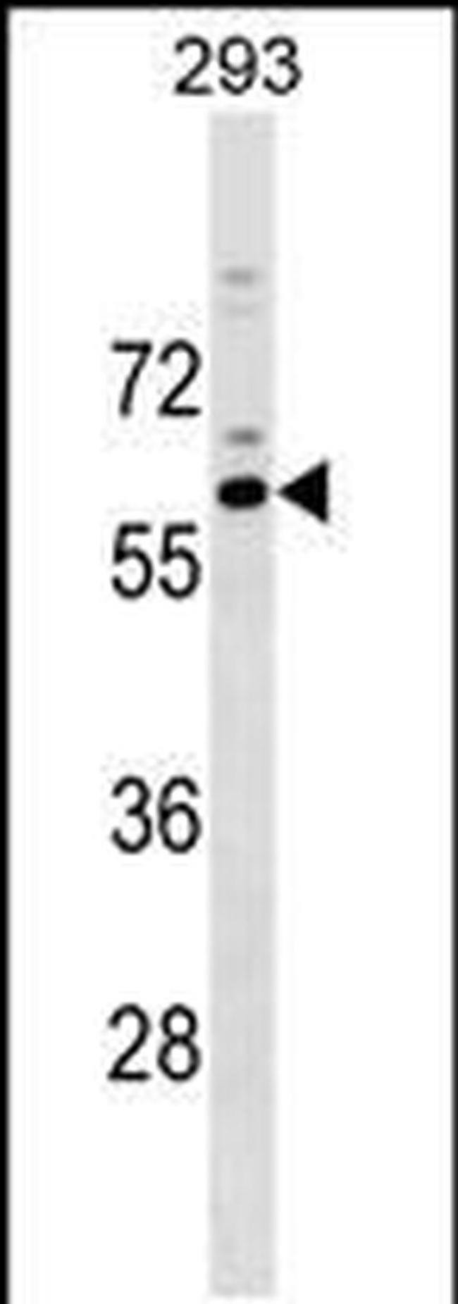 RASGEF1C Antibody in Western Blot (WB)