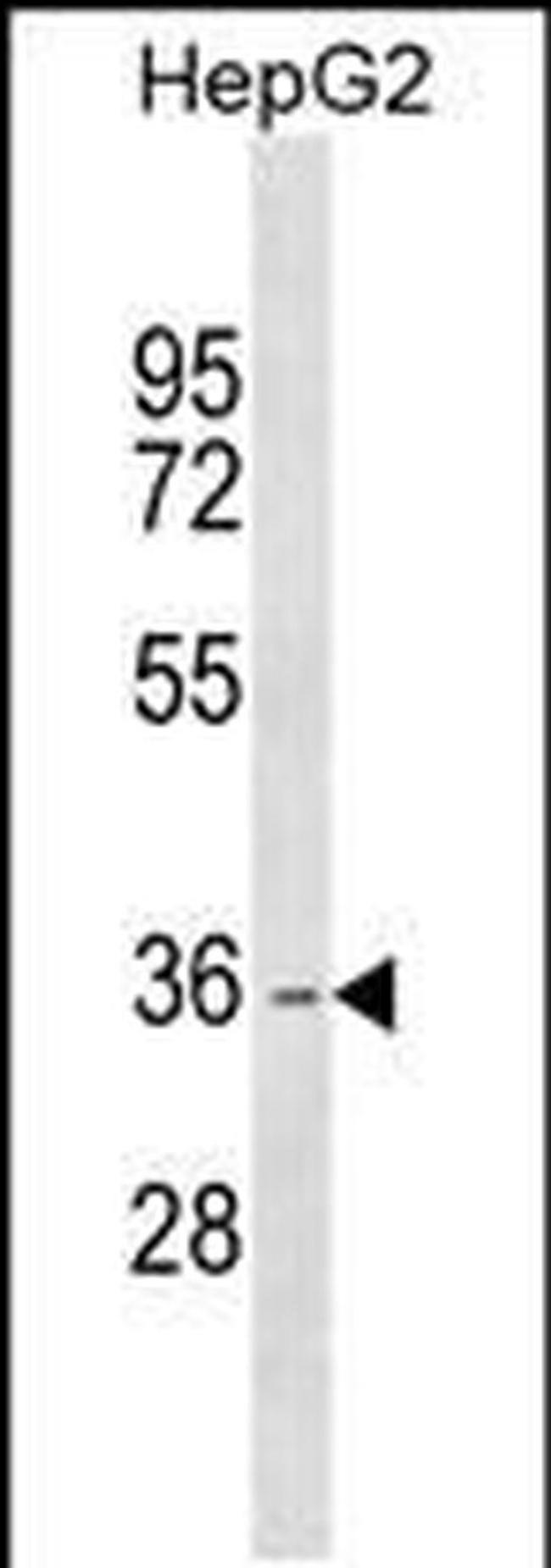 DHRS1 Antibody in Western Blot (WB)