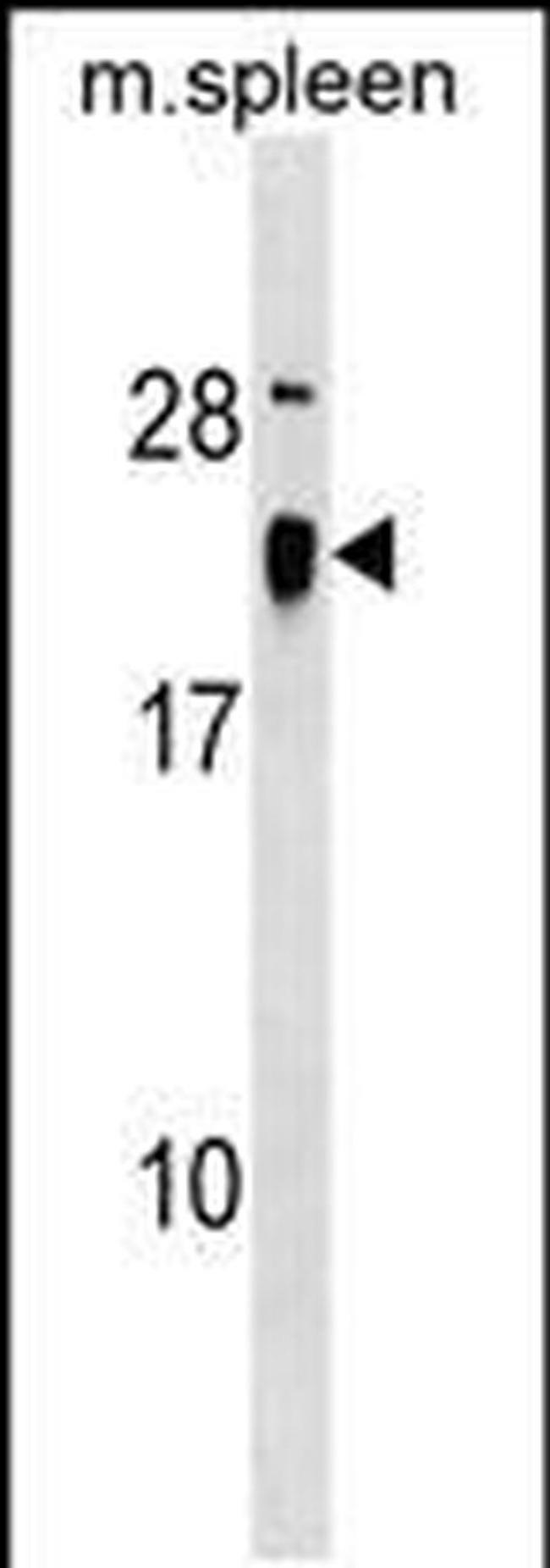 ALG13 Antibody in Western Blot (WB)