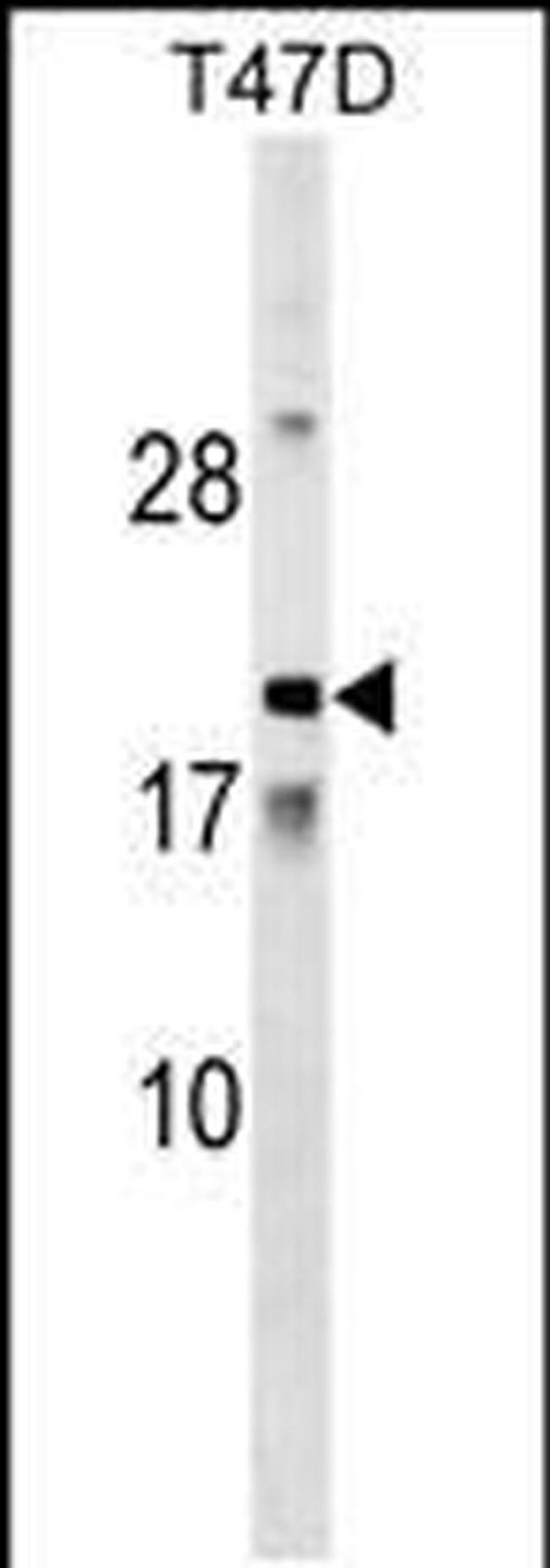AMTN Antibody in Western Blot (WB)