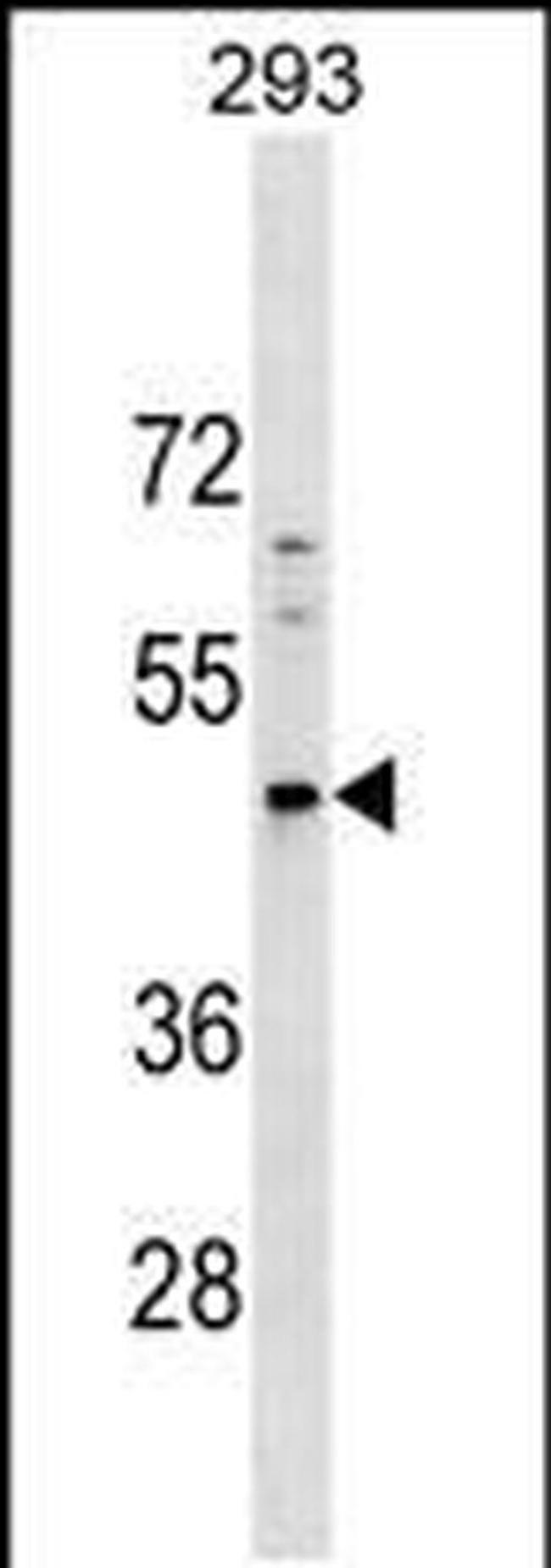 PNMA5 Antibody in Western Blot (WB)