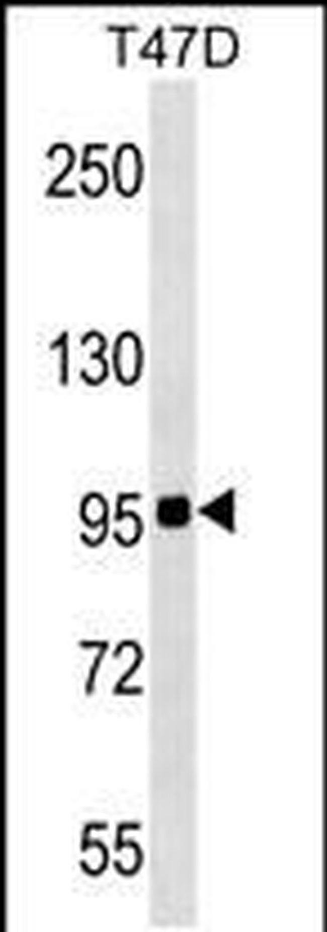 ZNF606 Antibody in Western Blot (WB)