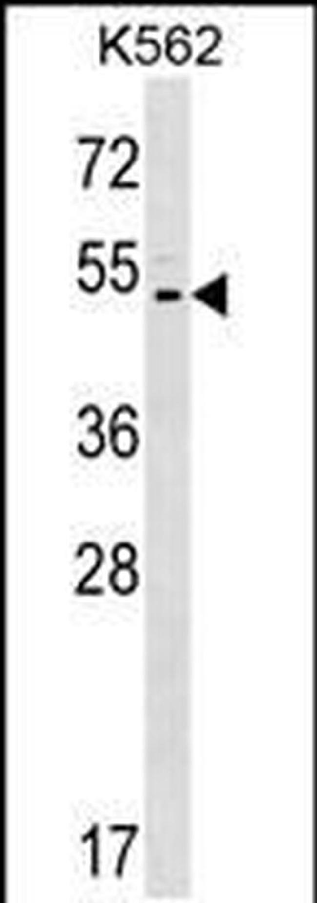 ASIC5 Antibody in Western Blot (WB)