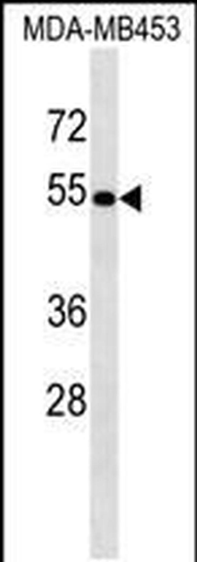 ACCS Antibody in Western Blot (WB)