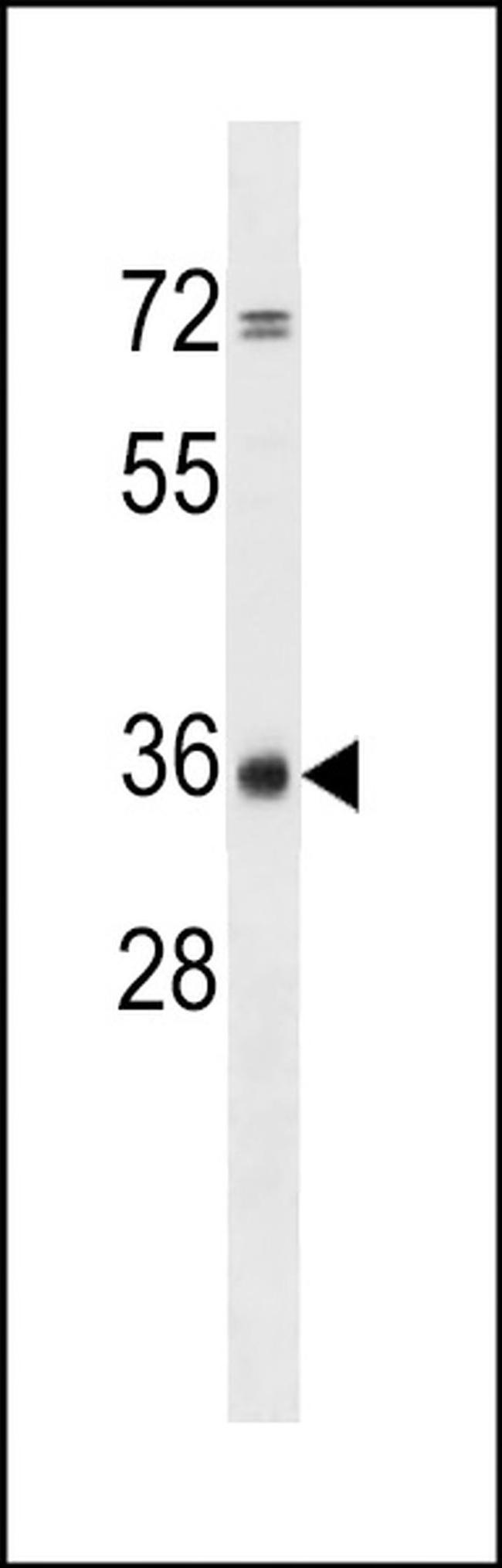 CPPED1 Antibody in Western Blot (WB)