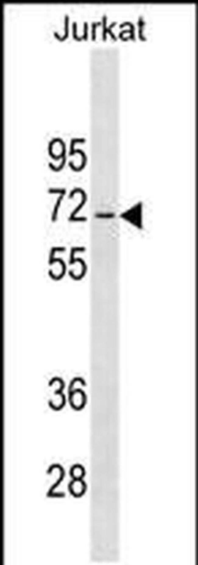 JRKL Antibody in Western Blot (WB)