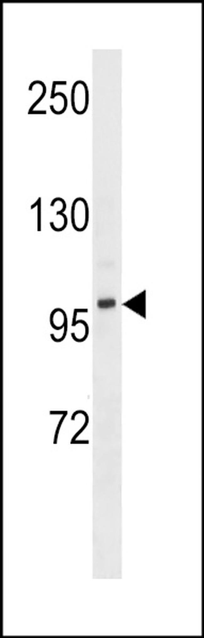 DMGDH Antibody in Western Blot (WB)