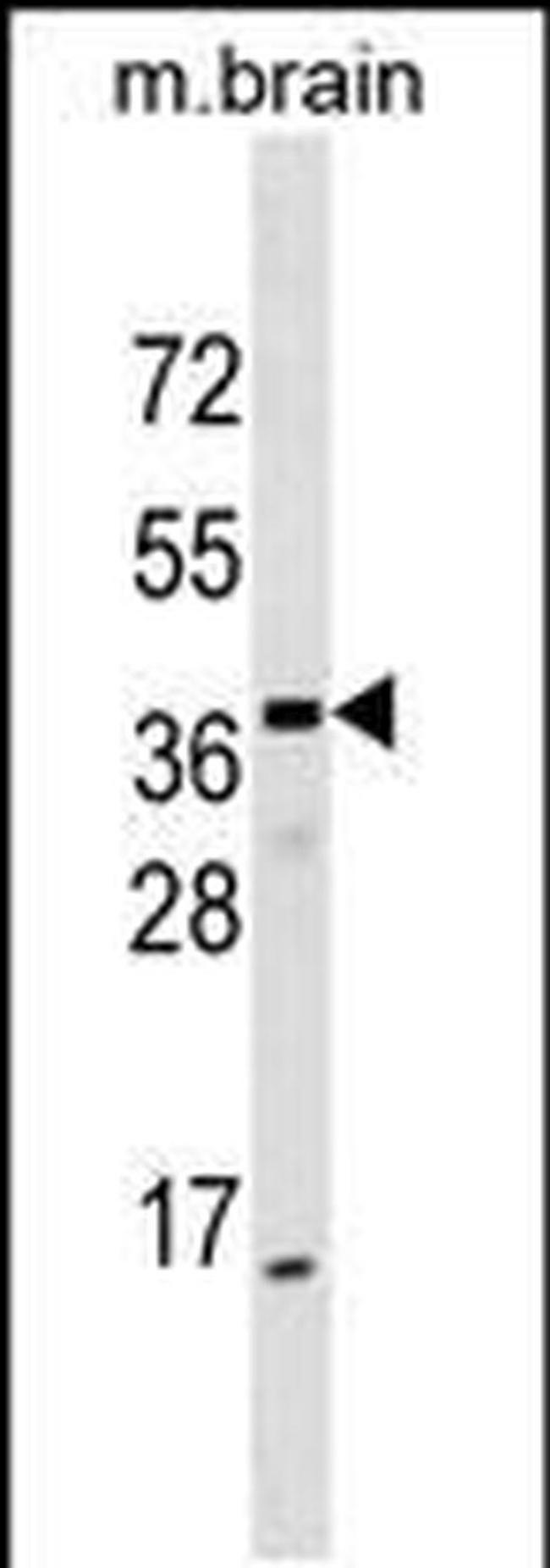 ELMOD1 Antibody in Western Blot (WB)