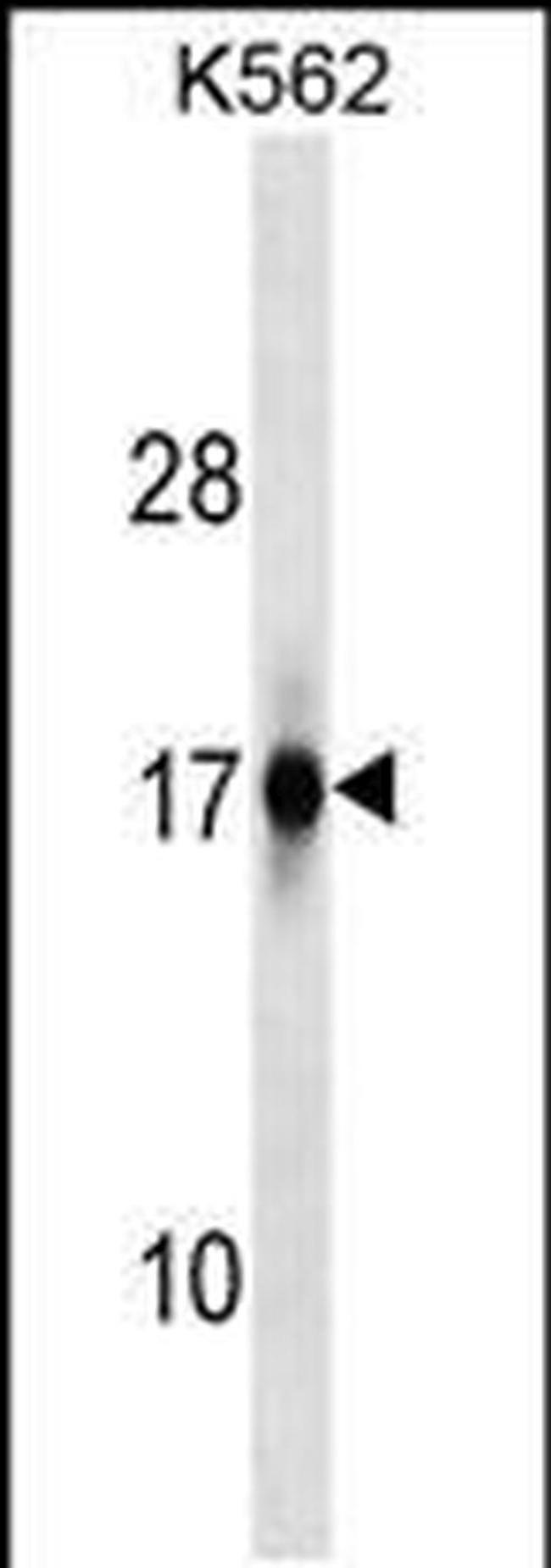 ZFAND2A Antibody in Western Blot (WB)
