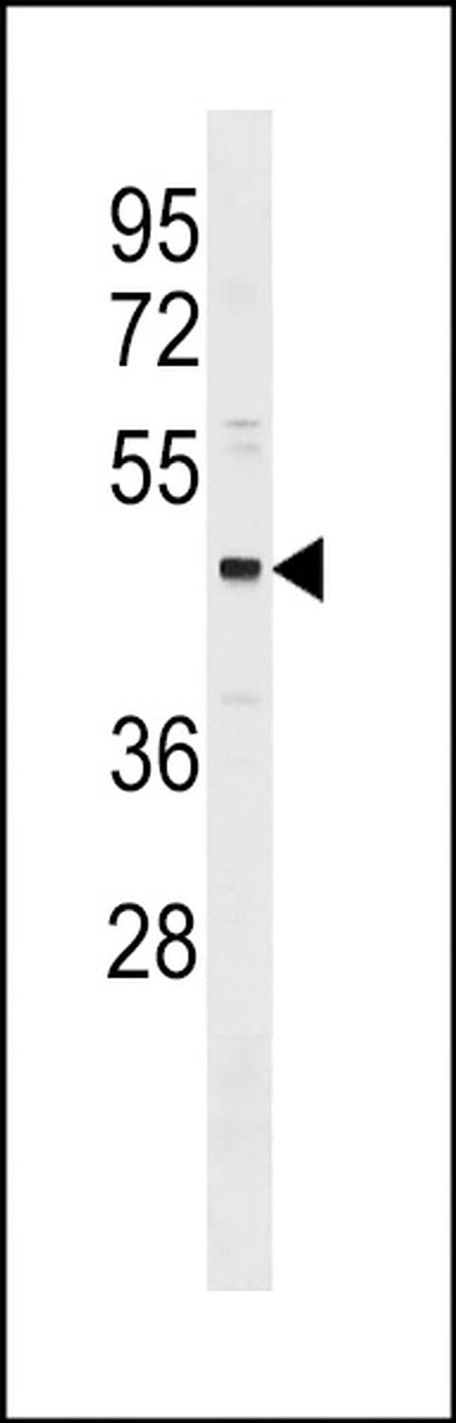 ONECUT3 Antibody in Western Blot (WB)