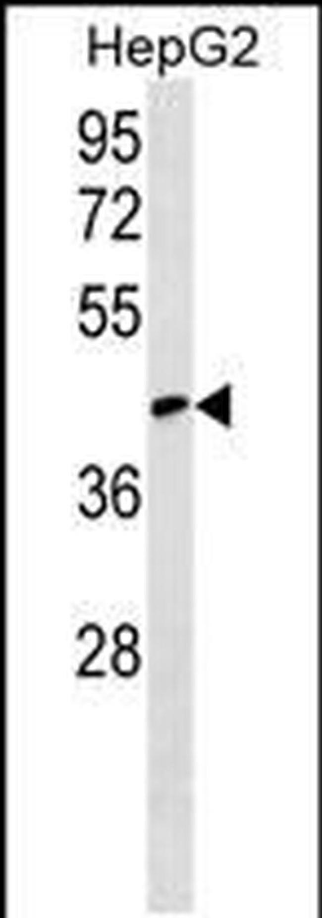 RCSD1 Antibody in Western Blot (WB)