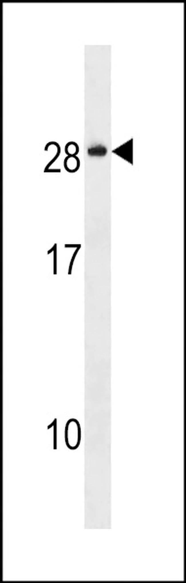NKAIN4 Antibody in Western Blot (WB)