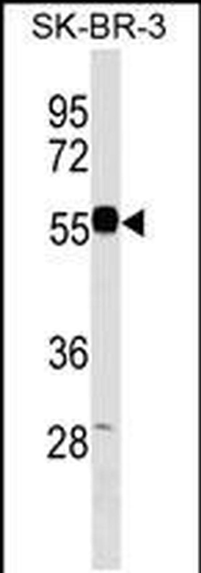 EEPD1 Antibody in Western Blot (WB)