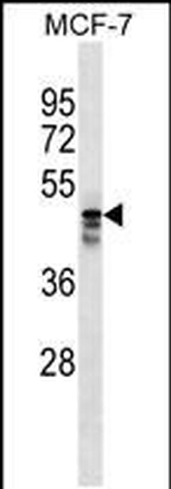 AP5M1 Antibody in Western Blot (WB)
