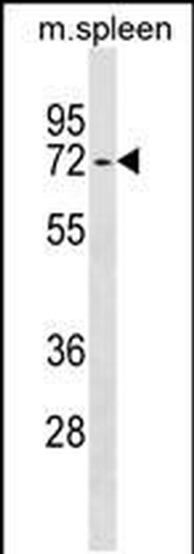 ENTPD4 Antibody in Western Blot (WB)