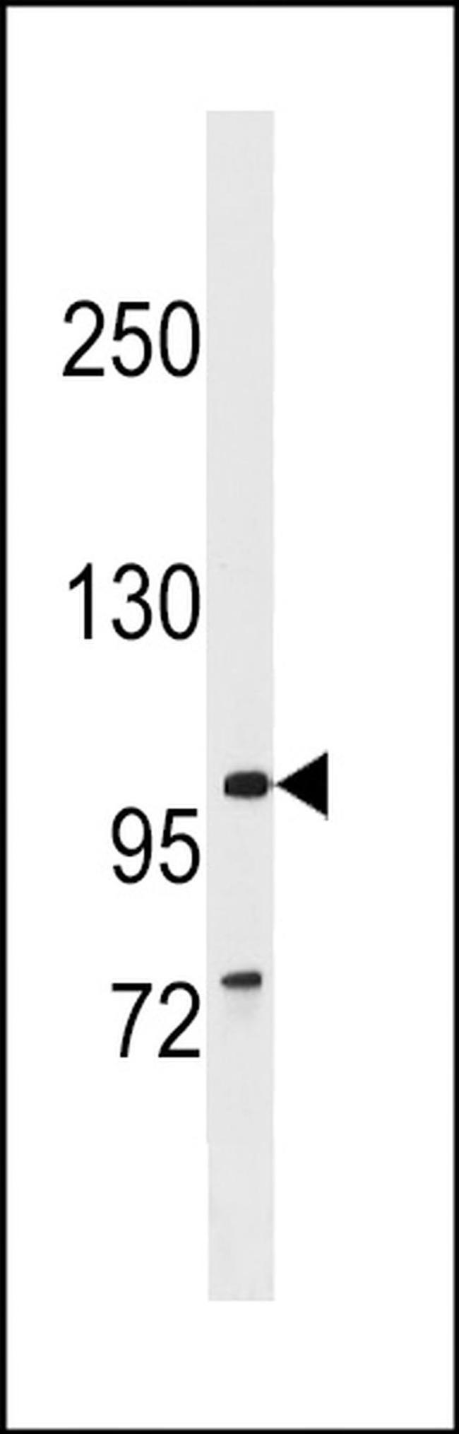 BBS9 Antibody in Western Blot (WB)