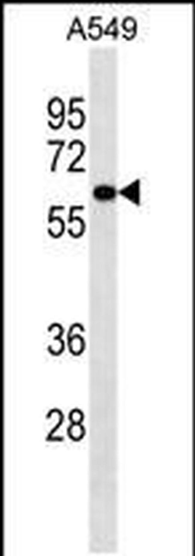 PIGS Antibody in Western Blot (WB)