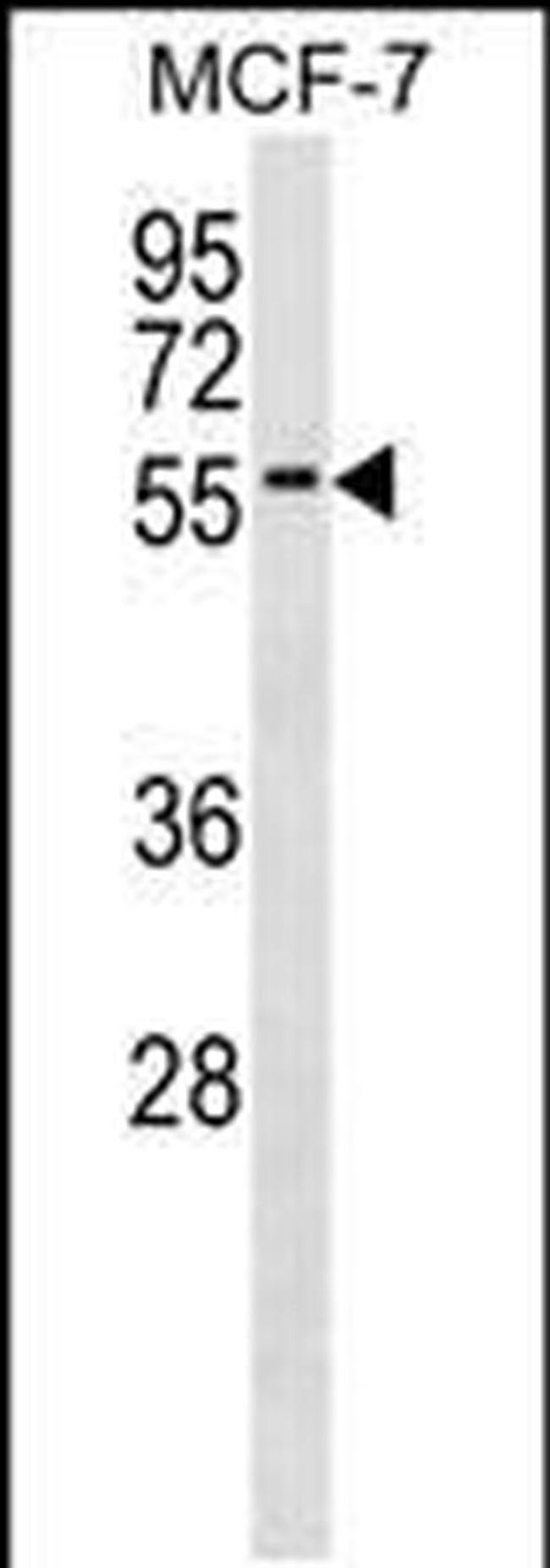 ZNF787 Antibody in Western Blot (WB)