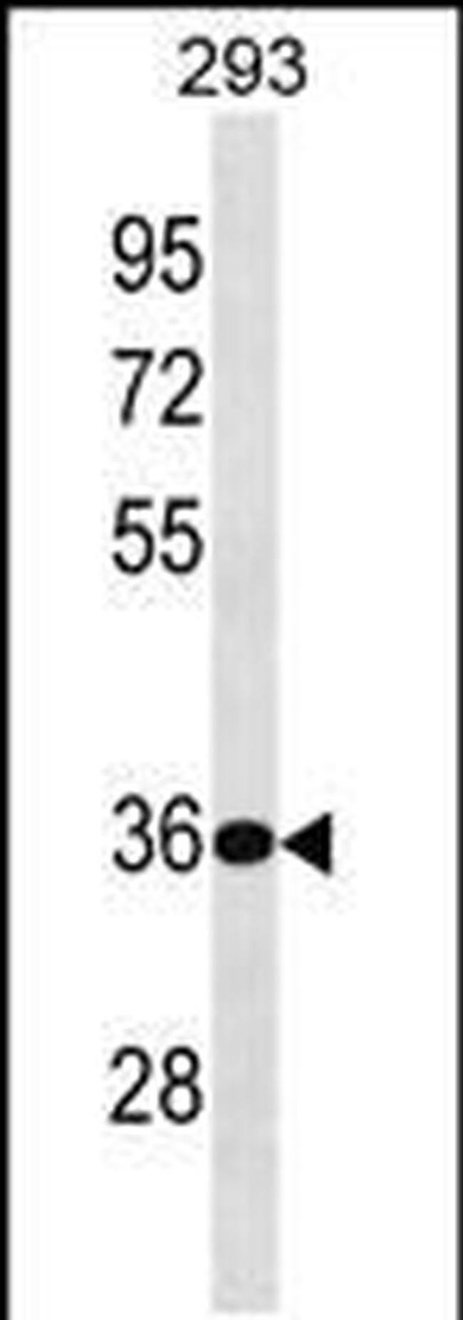 BPHL Antibody in Western Blot (WB)