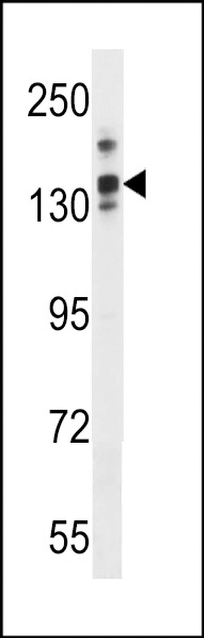 LRRC16A Antibody in Western Blot (WB)