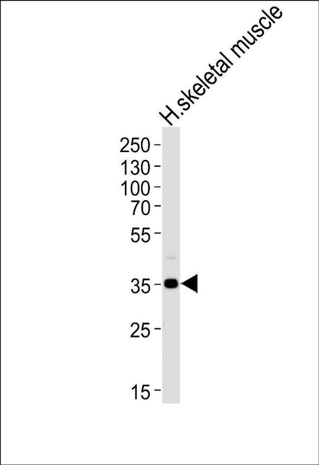 PPP1R3B Antibody in Western Blot (WB)