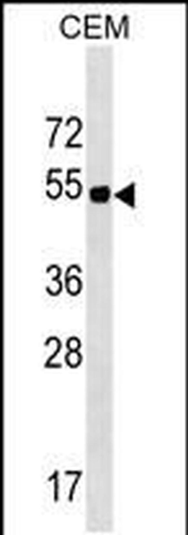 ELL3 Antibody in Western Blot (WB)