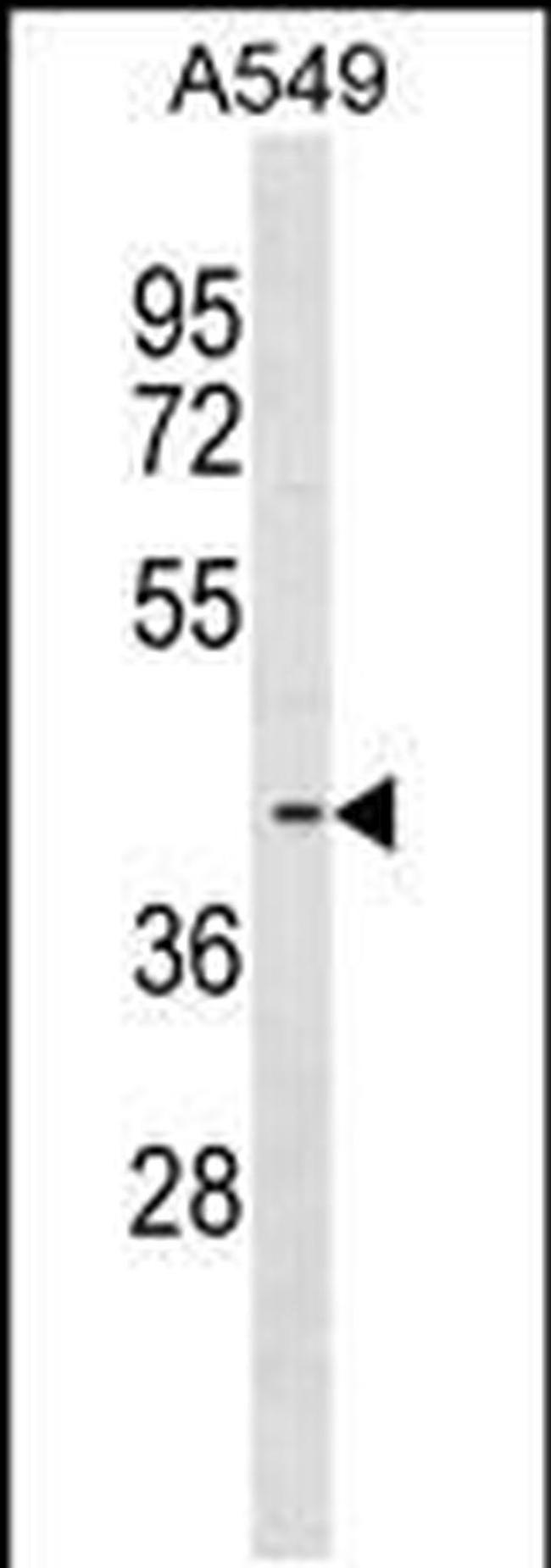 FADS3 Antibody in Western Blot (WB)