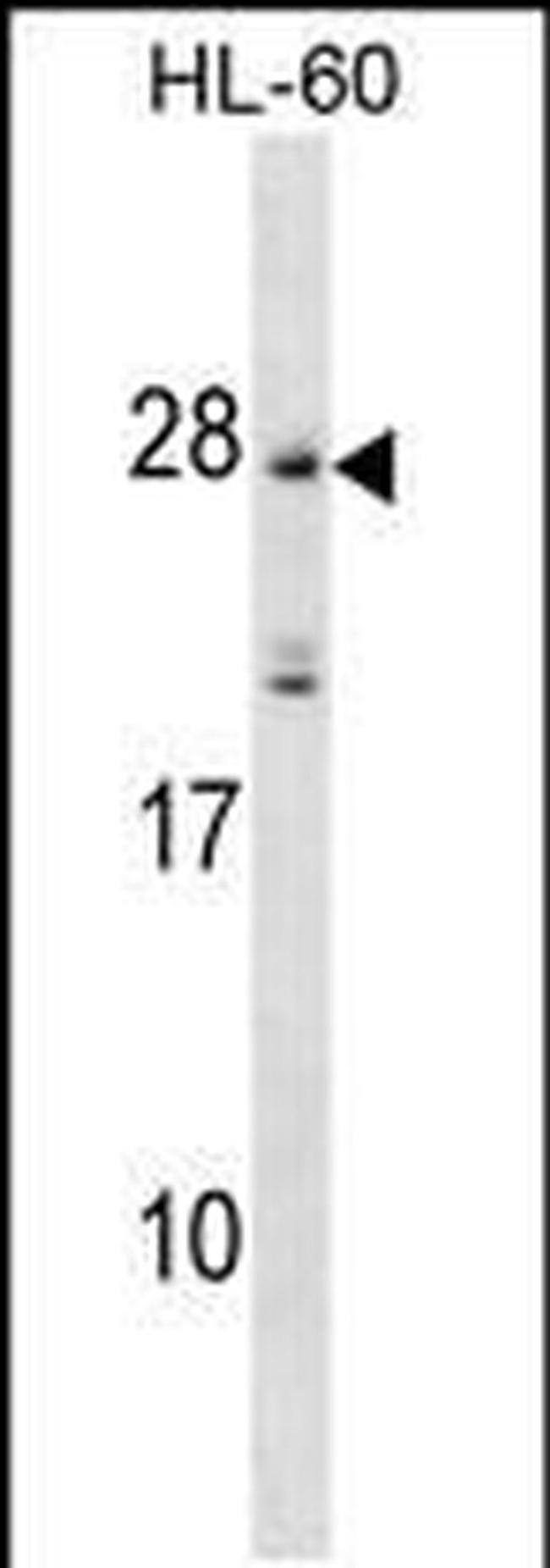 MS4A5 Antibody in Western Blot (WB)
